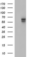 IL10RA Antibody - HEK293T cells were transfected with the pCMV6-ENTRY control (Left lane) or pCMV6-ENTRY IL10RA (Right lane) cDNA for 48 hrs and lysed. Equivalent amounts of cell lysates (5 ug per lane) were separated by SDS-PAGE and immunoblotted with anti-IL10RA. At a dilution of 1:4000. 