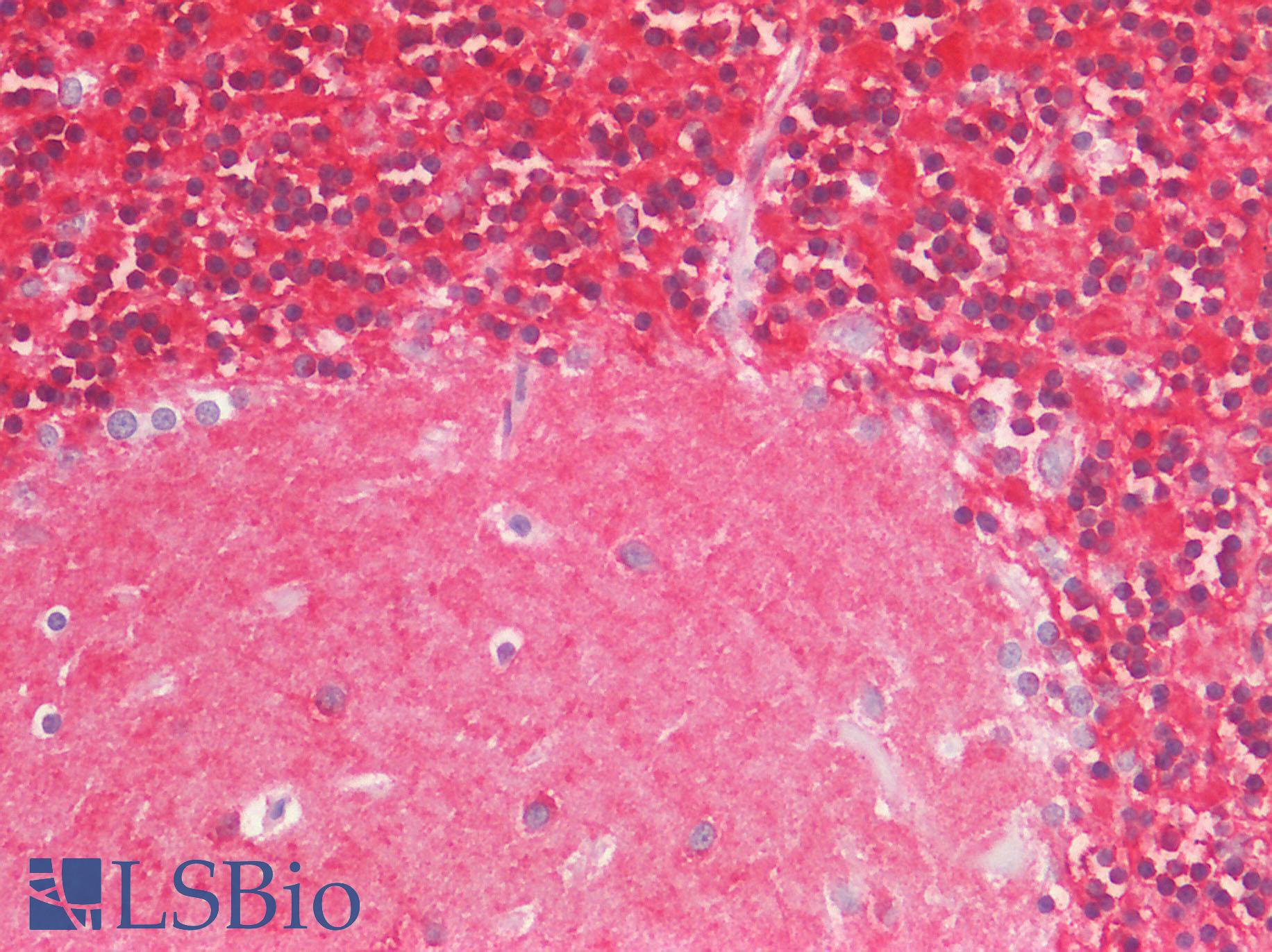 IL17A Antibody - Positive Staining in Human Brain, Cerebellum: Formalin-Fixed, Paraffin-Embedded (FFPE)