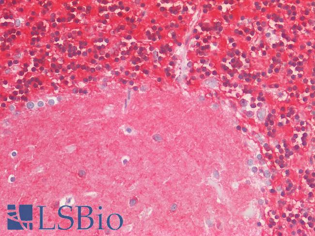 IL17A Antibody - Positive Staining in Human Brain, Cerebellum: Formalin-Fixed, Paraffin-Embedded (FFPE)