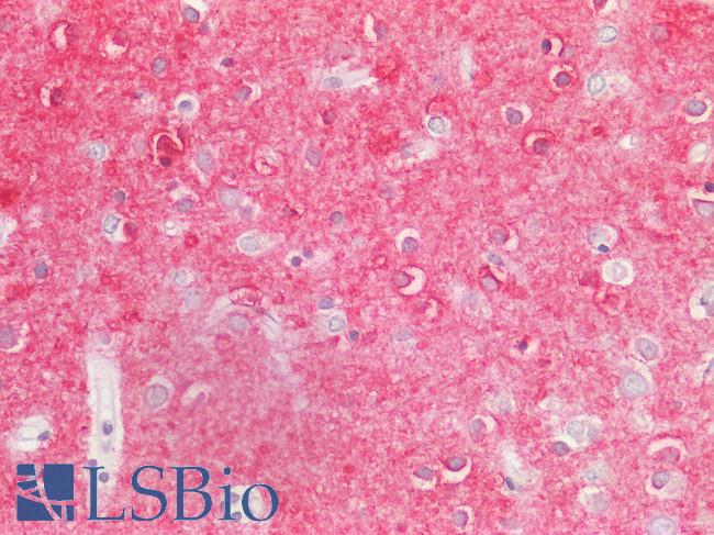 IL17A Antibody - Positive Staining in Human Brain, Cortex: Formalin-Fixed, Paraffin-Embedded (FFPE)