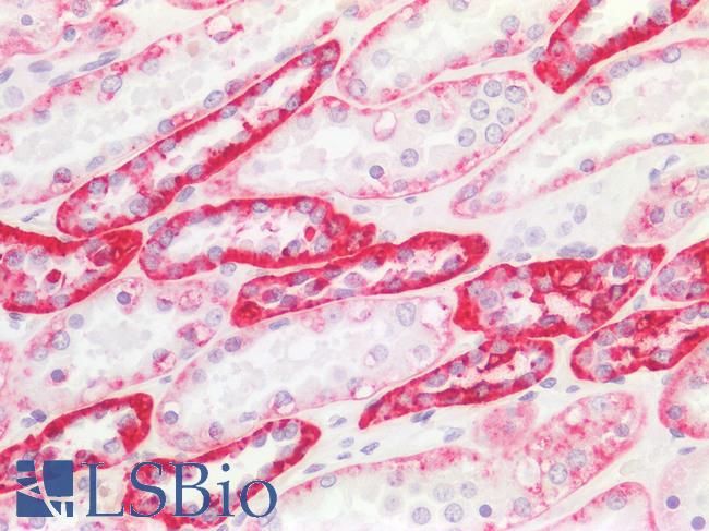 IL17A Antibody - Positive Staining in Human Kidney Tubules: Formalin-Fixed, Paraffin-Embedded (FFPE)