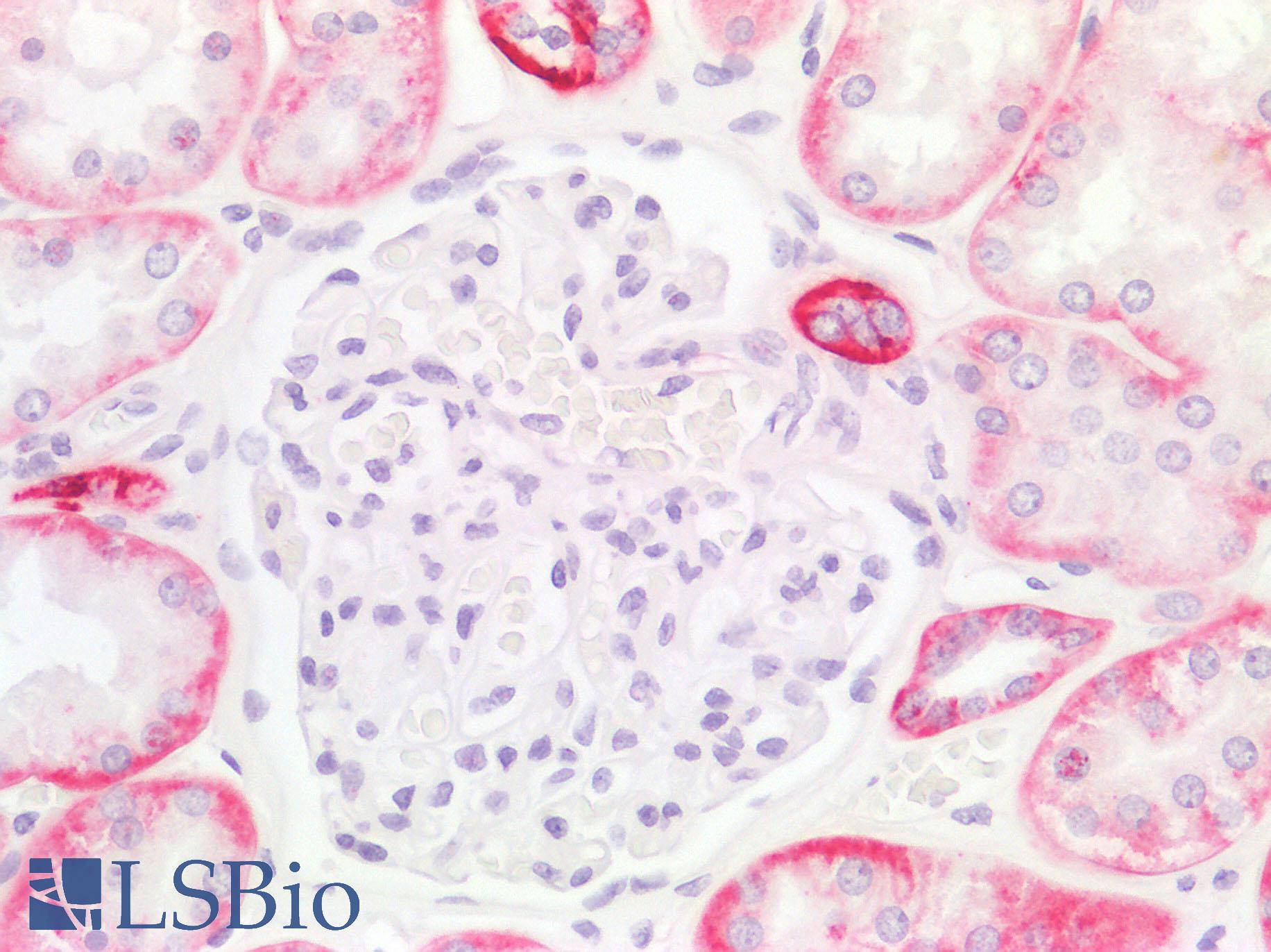 IL17A Antibody - Negative Staining in Human Kidney Glomerulus: Formalin-Fixed, Paraffin-Embedded (FFPE)