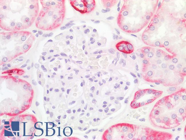 IL17A Antibody - Negative Staining in Human Kidney Glomerulus: Formalin-Fixed, Paraffin-Embedded (FFPE)