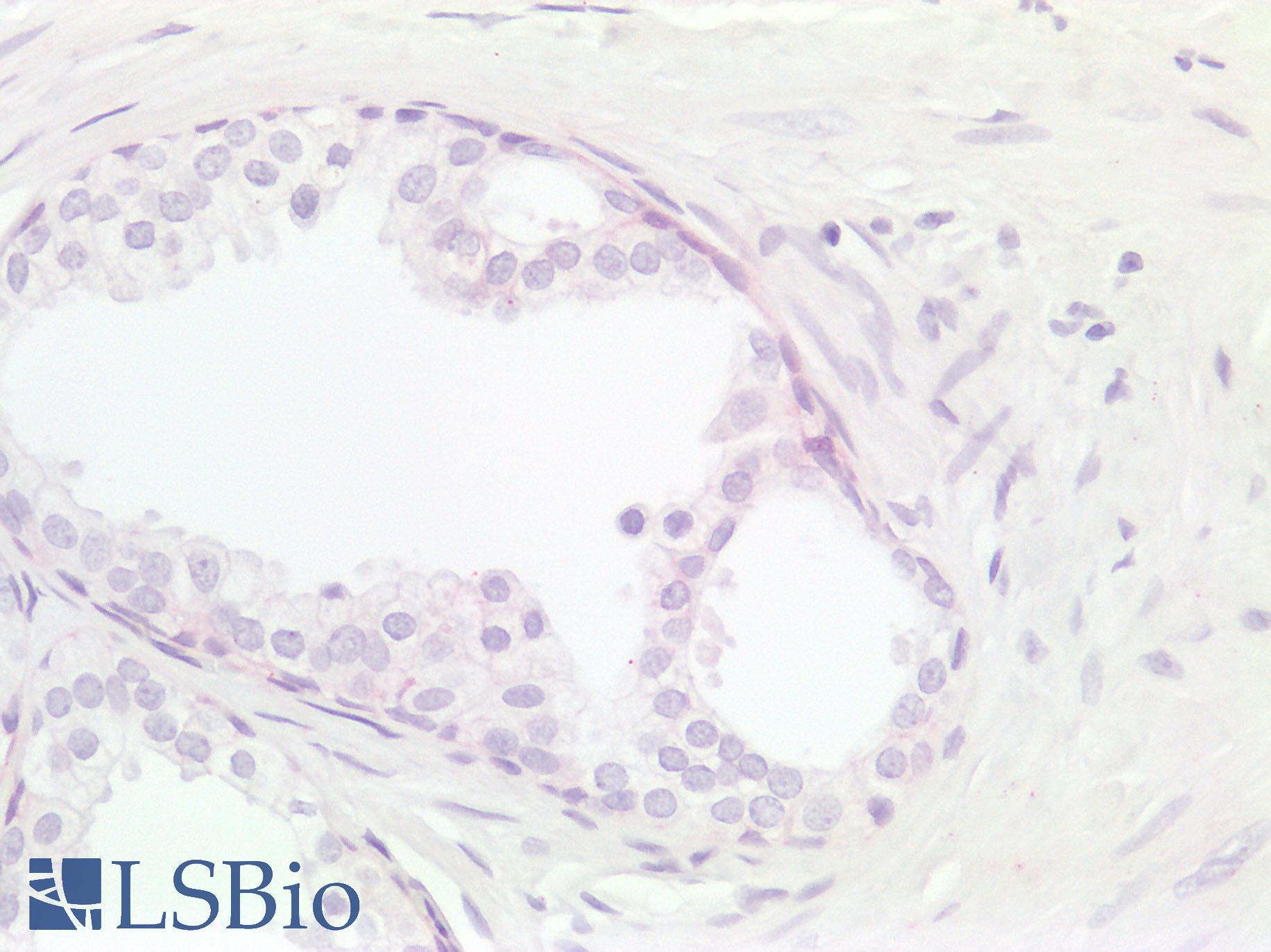 IL17A Antibody - Negative Staining in Human Prostate: Formalin-Fixed, Paraffin-Embedded (FFPE)