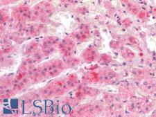IL17A Antibody - Human Adrenal: Formalin-Fixed, Paraffin-Embedded (FFPE)