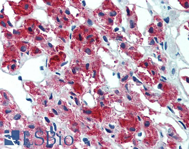 IL23A / IL-23 p19 Antibody - Anti-IL-23 p19 antibody IHC of human adrenal. Immunohistochemistry of formalin-fixed, paraffin-embedded tissue after heat-induced antigen retrieval. Antibody concentration 10 ug/ml.