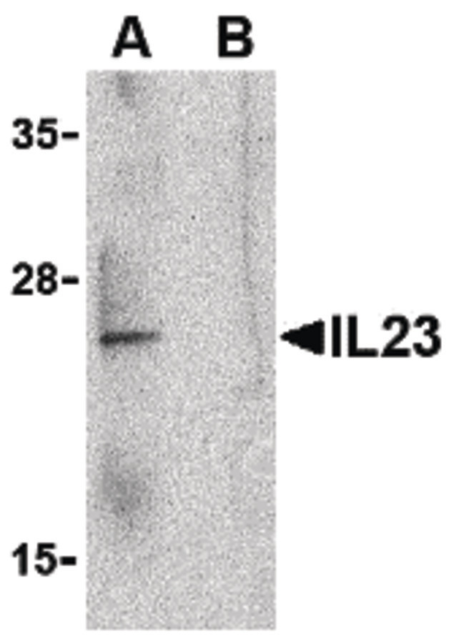 IL23A / IL-23 p19 Antibody - Western blot of IL-23 in Raji lysate with IL-23 antibody at 1 ug/ml in the (A) absence and (B) presence of blocking peptide.