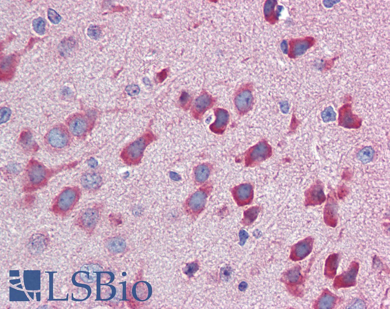 IL23A / IL-23 p19 Antibody - Anti-IL-23 p19 antibody IHC staining of mouse brain. Immunohistochemistry of formalin-fixed, paraffin-embedded tissue after heat-induced antigen retrieval. Antibody concentration 5 ug/ml.