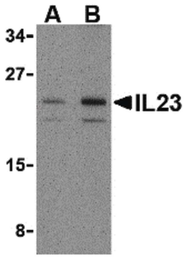 IL23A / IL-23 p19 Antibody - Western blot of IL-23 in mouse pancreas tissue lysate with IL-23 antibody at (A) 1 and (B) 2 ug/ml.