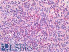 IL23R Antibody - Human Spleen: Formalin-Fixed, Paraffin-Embedded (FFPE)