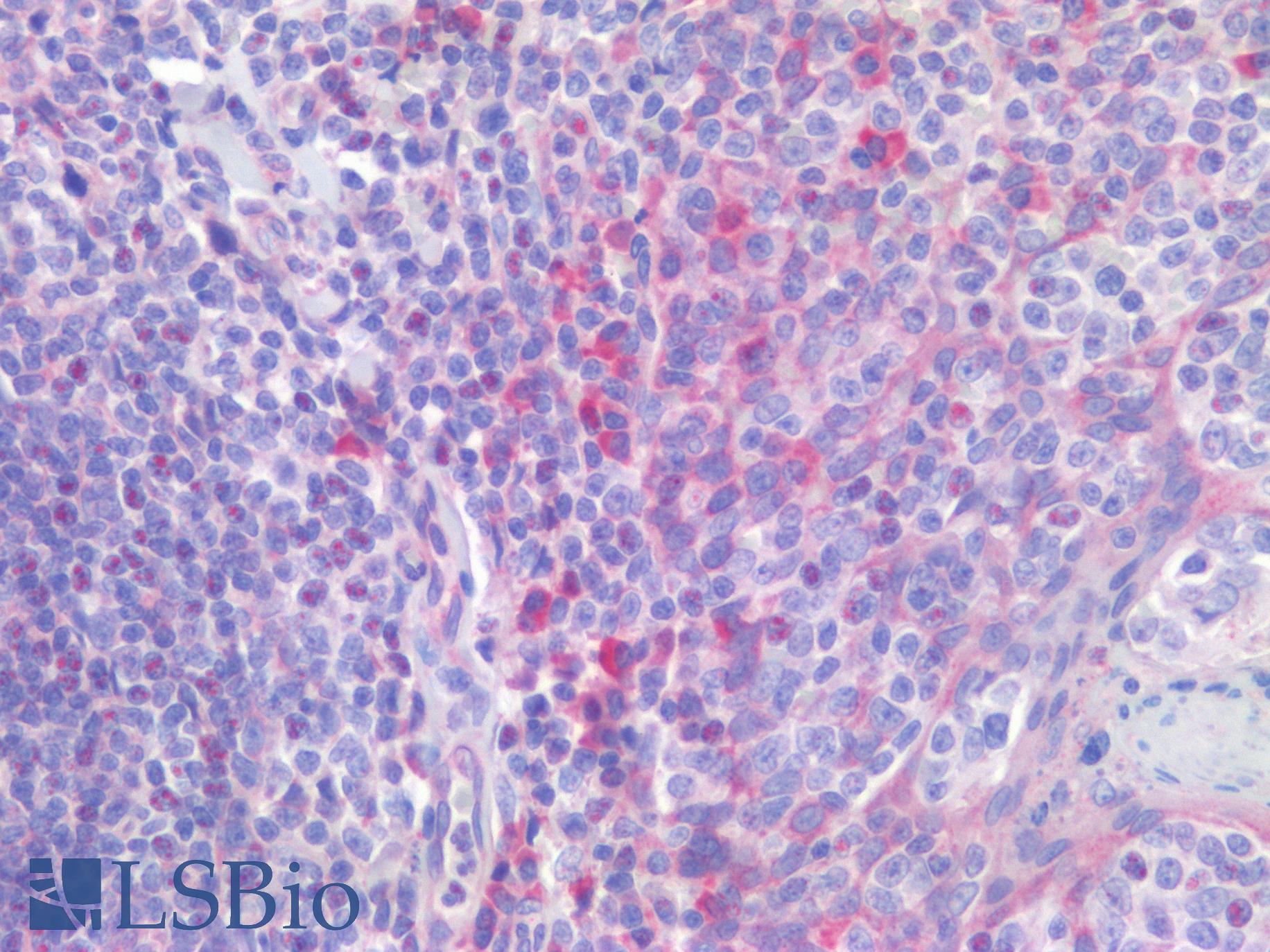 IL23R Antibody - Human Tonsil: Formalin-Fixed, Paraffin-Embedded (FFPE)