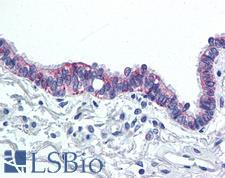 IL6 / Interleukin 6 Antibody - Anti-IL-6 antibody IHC of human lung, respiratory epithelium. Immunohistochemistry of formalin-fixed, paraffin-embedded tissue after heat-induced antigen retrieval.