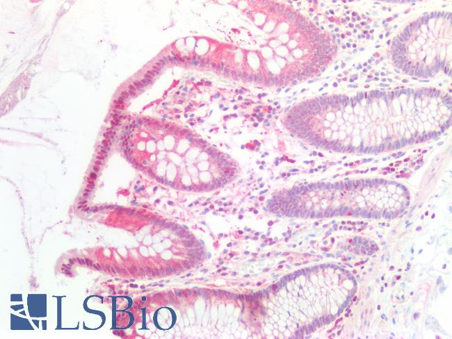 IL6ST / CD130 / gp130 Antibody - Human Colon: Formalin-Fixed, Paraffin-Embedded (FFPE)