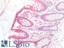 IL6ST / CD130 / gp130 Antibody - Human Colon: Formalin-Fixed, Paraffin-Embedded (FFPE)