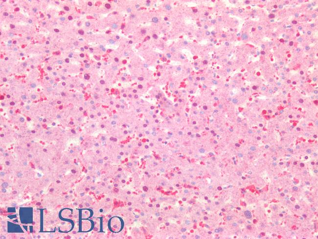 IL6ST / CD130 / gp130 Antibody - Human Liver: Formalin-Fixed, Paraffin-Embedded (FFPE)