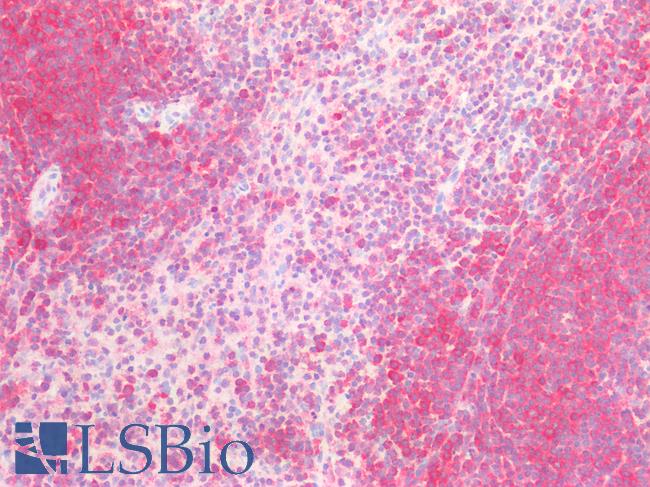 IL6ST / CD130 / gp130 Antibody - Human Spleen: Formalin-Fixed, Paraffin-Embedded (FFPE)