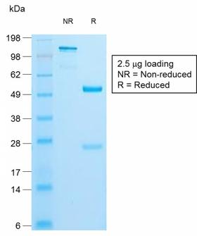 Insulin Antibody - SDS-PAGE Analysis of Purified Insulin Rabbit Recombinant Monoclonal Antibody (IRDN/1980R). Confirmation of Purity and Integrity of Antibody.