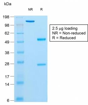Insulin Antibody - SDS-PAGE Analysis Purified Insulin Mouse Recombinant Monoclonal Antibody (rIRDN/805). Confirmation of Purity and Integrity of Antibody.