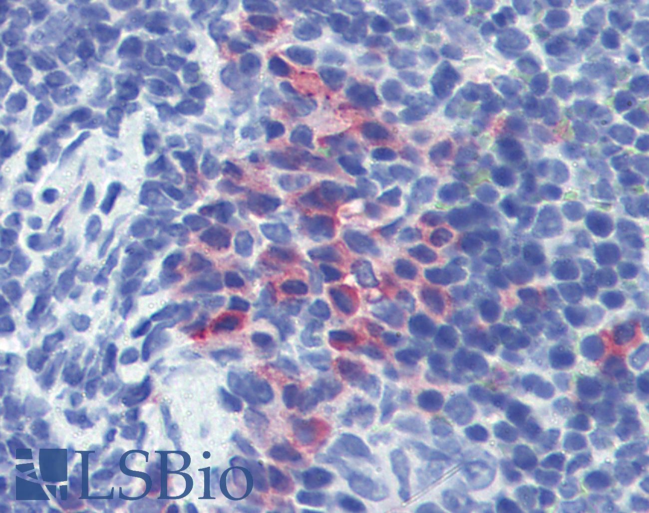 ITGAM / CD11b Antibody - Anti-CD11b antibody IHC of mouse spleen. Immunohistochemistry of formalin-fixed, paraffin-embedded tissue after heat-induced antigen retrieval. Antibody concentration 10 ug/ml.