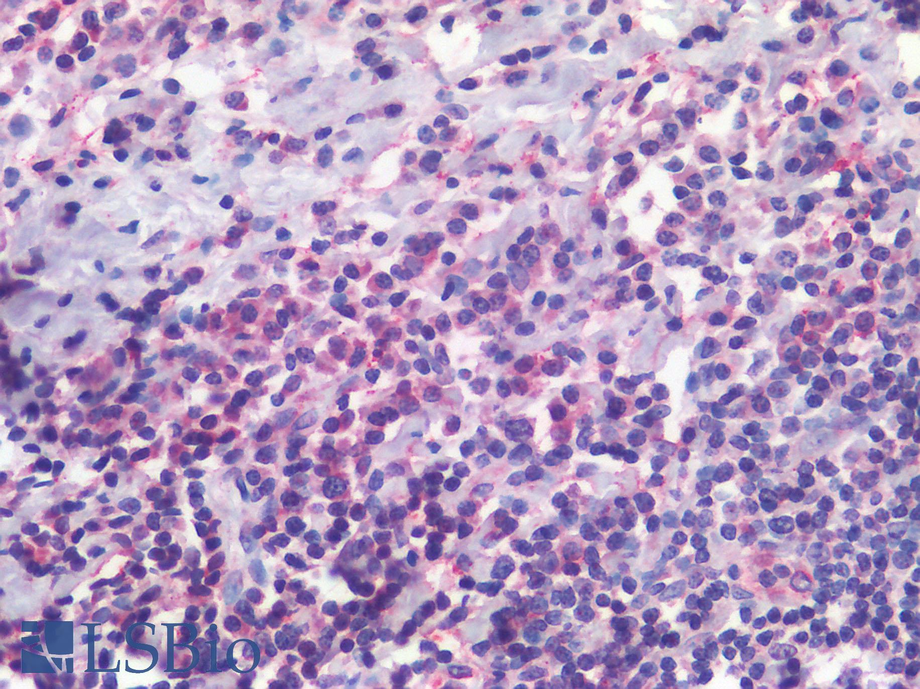 ITGAX / CD11c Antibody - Anti-CD11c antibody IHC of Human Tonsil. Positive staining within a subset of lymphocytes. Immunohistochemistry of formalin-fixed, paraffin-embedded tissue after heat-induced antigen retrieval.