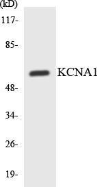 KCNA1 / Kv1.1 Antibody - Western blot analysis of the lysates from HepG2 cells using KCNA1 antibody.