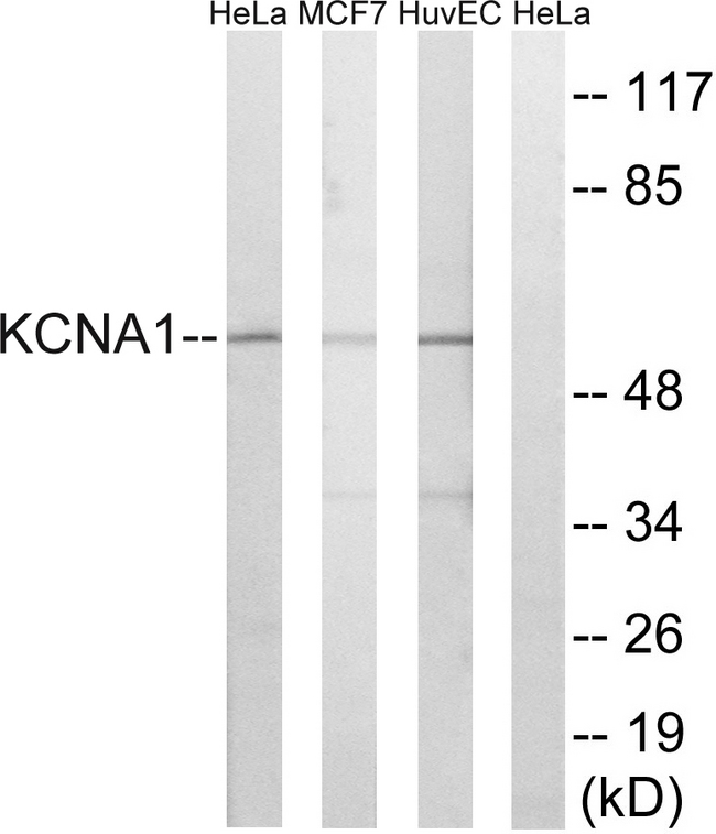KCNA1 / Kv1.1 Antibody - Western blot analysis of lysates from HUVEC, MCF-7, and HeLa cells, using KCNA1 Antibody. The lane on the right is blocked with the synthesized peptide.