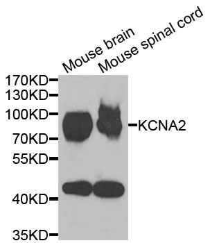KCNA2 / Kv1.2 Antibody - Western blot analysis of extracts of various cells.