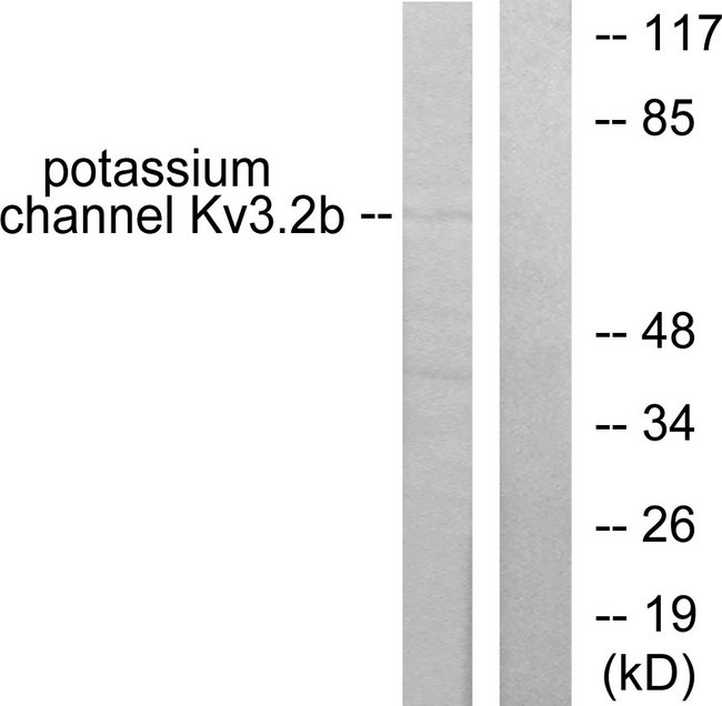 KCNC2 / Kv3.2 Antibody - Western blot analysis of lysates from HepG2 cells, using Potassium Channel Kv3.2b Antibody. The lane on the right is blocked with the synthesized peptide.