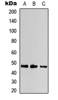 KCNJ2 / Kir2.1 Antibody - Western blot analysis of Kir2.1 expression in HeLa (A); mouse brain (B); rat kidney (C) whole cell lysates.