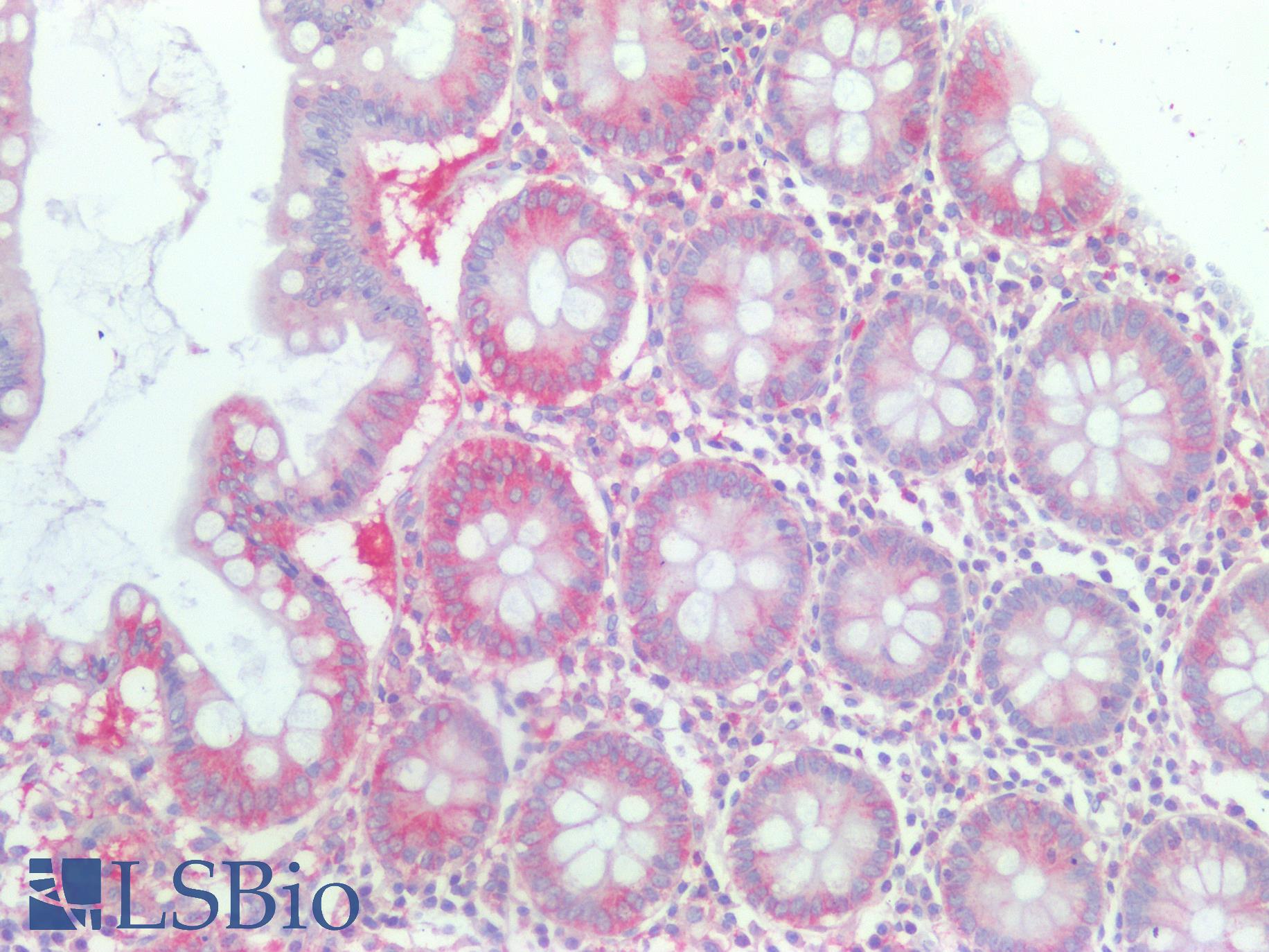 Kinesin Heavy Chain / KIF5B Antibody - Human Colon: Formalin-Fixed, Paraffin-Embedded (FFPE)