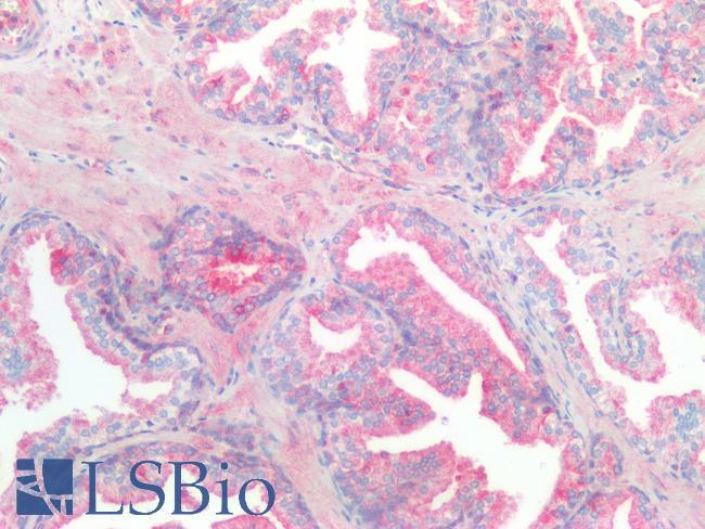 Kinesin Heavy Chain / KIF5B Antibody - Human Prostate: Formalin-Fixed, Paraffin-Embedded (FFPE)