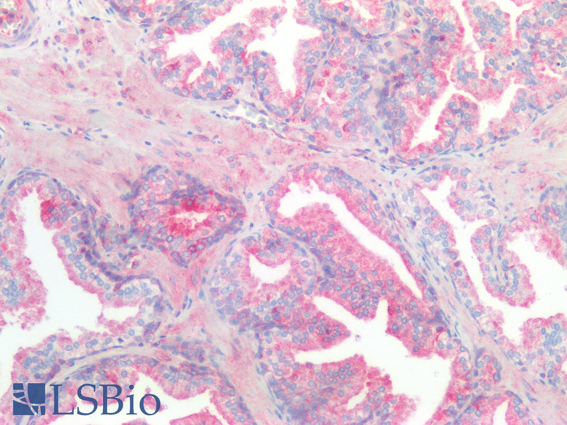 Kinesin Heavy Chain / KIF5B Antibody - Human Prostate: Formalin-Fixed, Paraffin-Embedded (FFPE)