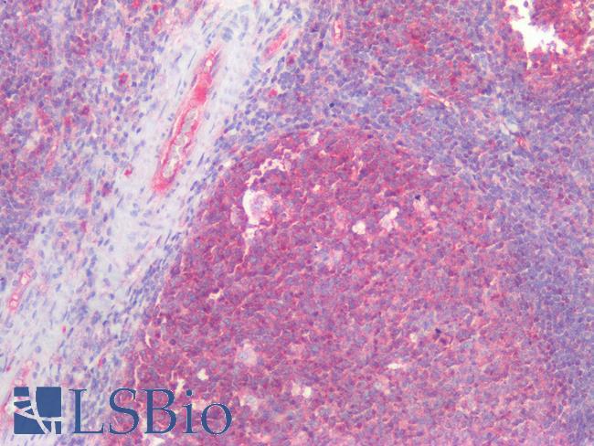 Kinesin Heavy Chain / KIF5B Antibody - Human Tonsil: Formalin-Fixed, Paraffin-Embedded (FFPE)