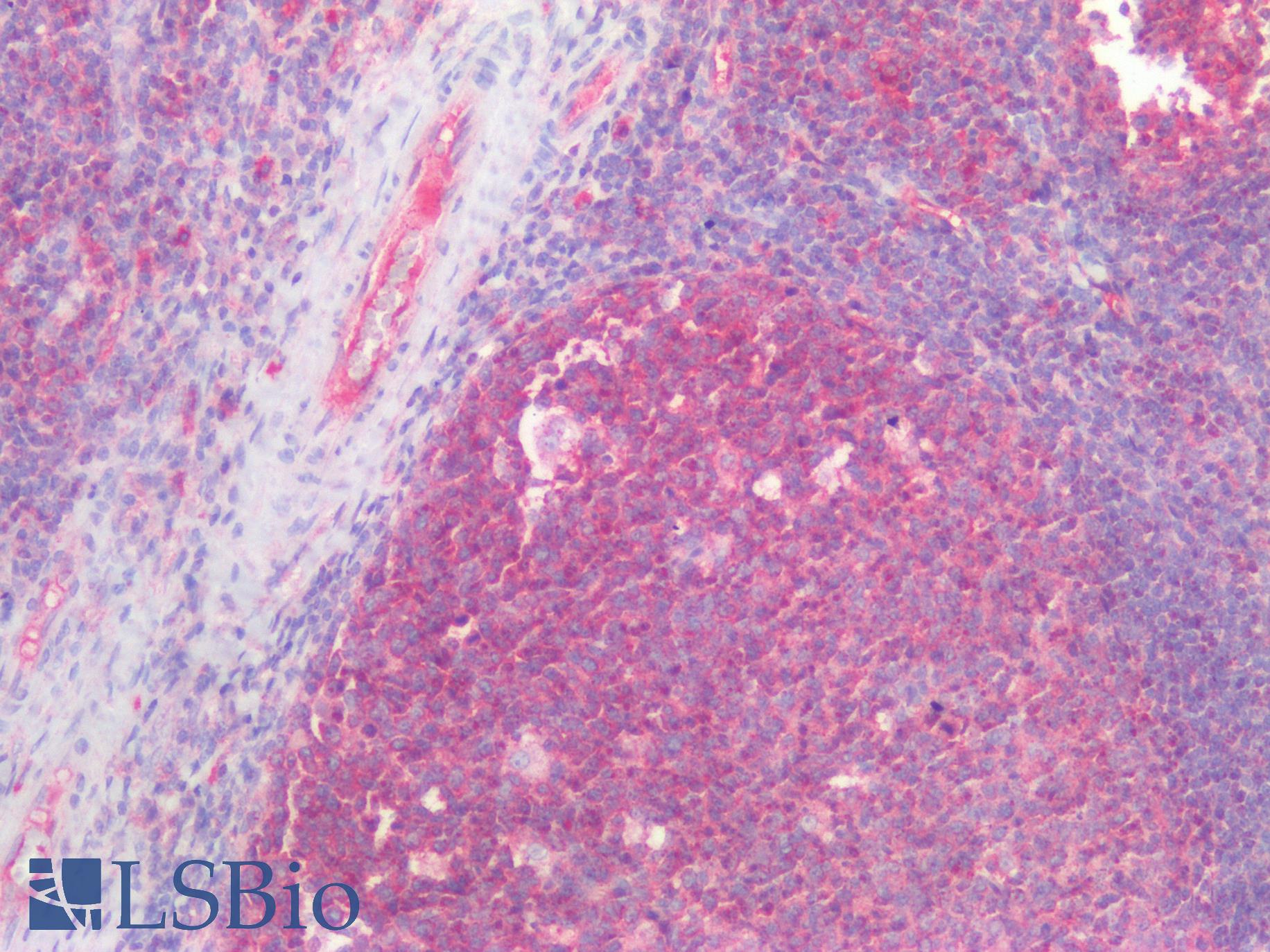 Kinesin Heavy Chain / KIF5B Antibody - Human Tonsil: Formalin-Fixed, Paraffin-Embedded (FFPE)