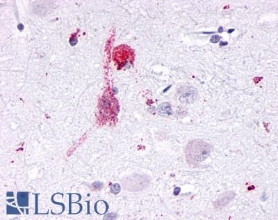 KISS1R / GPR54 Antibody - Brain, Amygdala