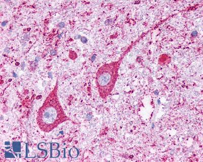 KISS1R / GPR54 Antibody - Brain, Medulla