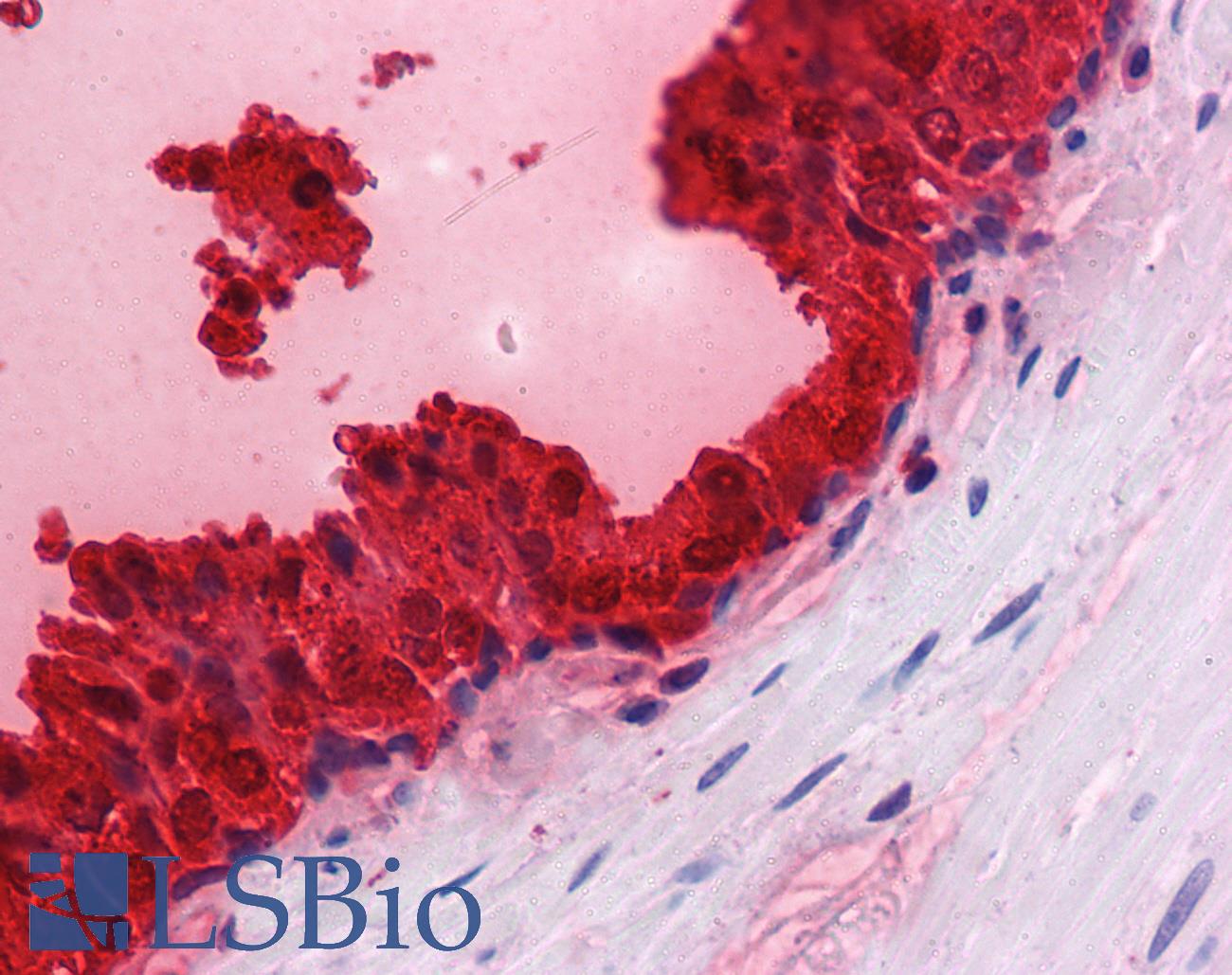 KLK3 / PSA Antibody - Anti-KLK3 / PSA antibody IHC of human prostate. Immunohistochemistry of formalin-fixed, paraffin-embedded tissue after heat-induced antigen retrieval. Antibody concentration 5 ug/ml.