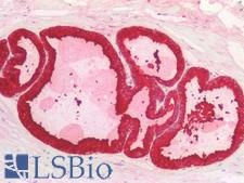 KLK3 / PSA Antibody - Human Prostate: Formalin-Fixed, Paraffin-Embedded (FFPE)