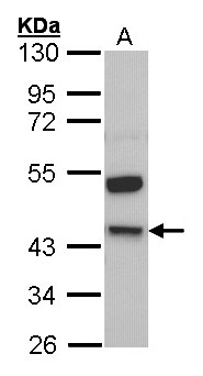 KNG1 / Kininogen / Bradykinin Antibody - Sample (30 ug of whole cell lysate). A: Molt-4 . 10% SDS PAGE. Kininogen / Bradykinin antibody diluted at 1:1000