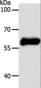 KRT10 / CK10 / Cytokeratin 10 Antibody - Western blot analysis of MCF7 cell, using KRT10 Polyclonal Antibody at dilution of 1:750.
