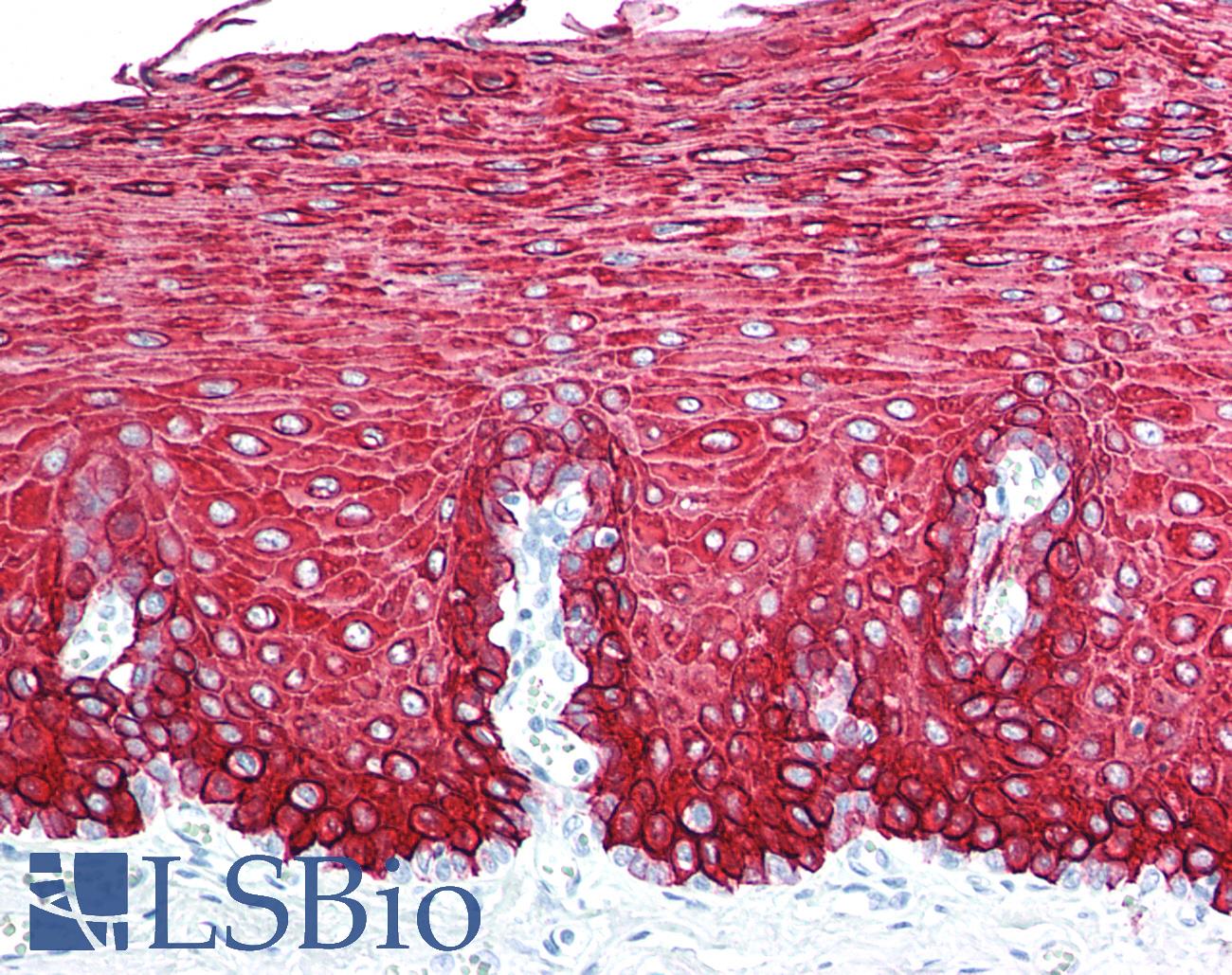 KRT13 / CK13 / Cytokeratin 13 Antibody - Human Esophagus: Formalin-Fixed, Paraffin-Embedded (FFPE)