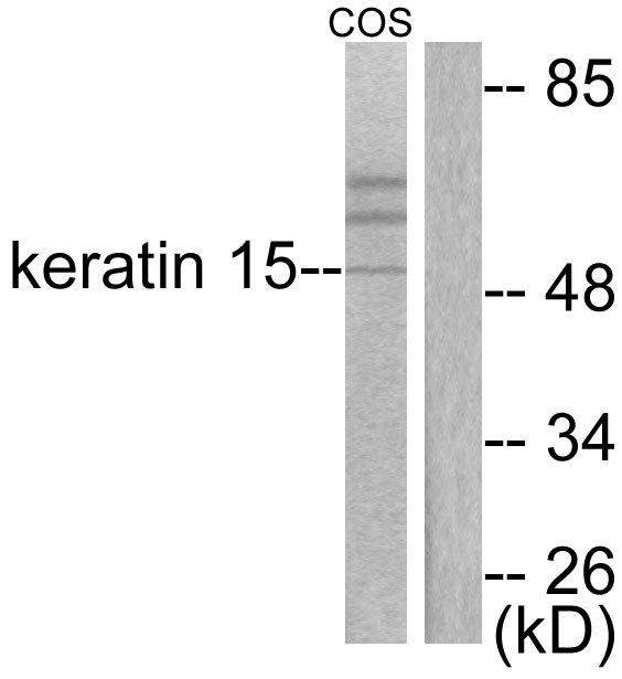 KRT15 / CK15 / Cytokeratin 15 Antibody - Western blot analysis of lysates from COS7 cells, using Keratin 15 Antibody. The lane on the right is blocked with the synthesized peptide.
