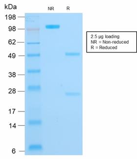 KRT16 / CK16 / Cytokeratin 16 Antibody - SDS-PAGE Analysis Purified CK16 Mouse Recombinant Monoclonal Antibody (KRT16/1714). Confirmation of Purity and Integrity of Antibody.