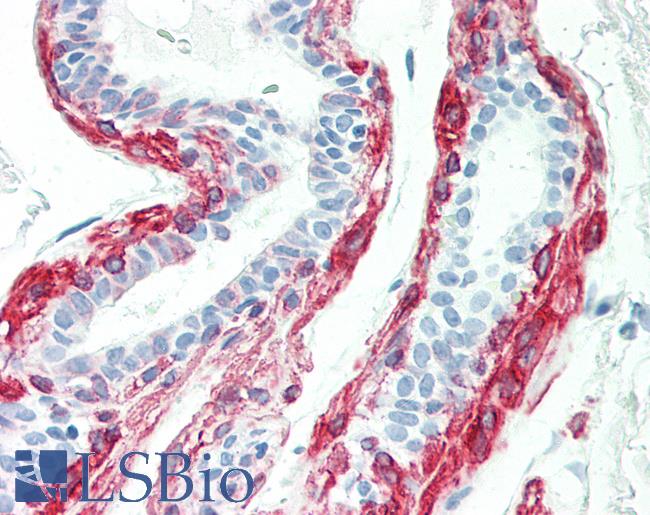 KRT17 / CK17 / Cytokeratin 17 Antibody - Human Breast: Formalin-Fixed, Paraffin-Embedded (FFPE)