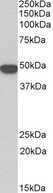 KRT18 / CK18 / Cytokeratin 18 Antibody - KRT18 antibody (0.1 ug/ml) staining of HeLa lysate (35 ug protein in RIPA buffer). Primary incubation was 1 hour. Detected by chemiluminescence.