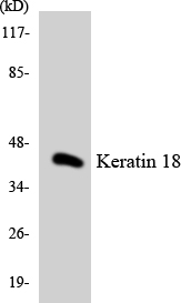 KRT18 / CK18 / Cytokeratin 18 Antibody - Western blot analysis of the lysates from COLO205 cells using Keratin 18 antibody.