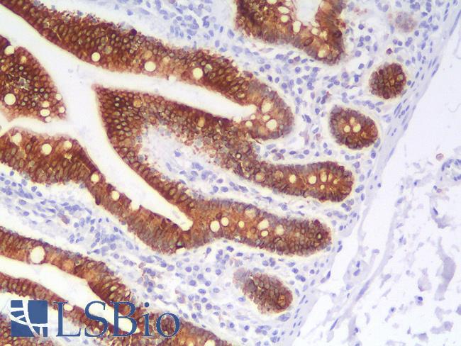KRT18 / CK18 / Cytokeratin 18 Antibody - Human Small Intestine: Formalin-Fixed, Paraffin-Embedded (FFPE)