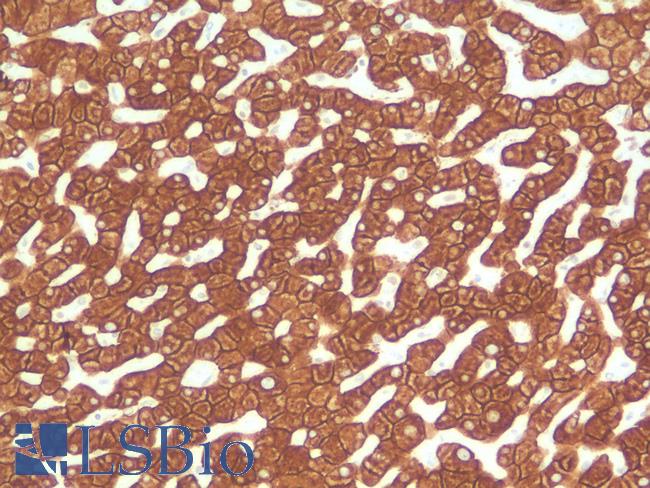 KRT18 / CK18 / Cytokeratin 18 Antibody - Human Liver: Formalin-Fixed, Paraffin-Embedded (FFPE)