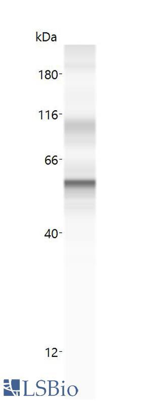 KRT18 / CK18 / Cytokeratin 18 Antibody - Anti-KRT18 antibody (LS-A10761, 20 µg/mL) yields a specific band on capillary Western analysis (Protein Simple, WES, 12-230 kDa separation module) in 0.25 mg/mL human cytokeratin 18 overexpression lysate. 