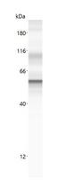KRT18 / CK18 / Cytokeratin 18 Antibody - Anti-KRT18 antibody (LS-A10761, 20 µg/mL) yields a specific band on capillary Western analysis (Protein Simple, WES, 12-230 kDa separation module) in 0.25 mg/mL human cytokeratin 18 overexpression lysate. 